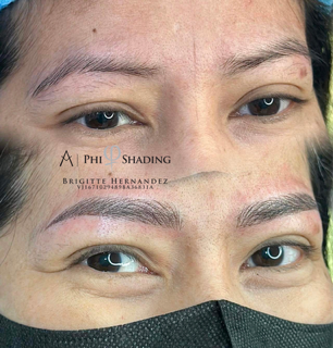 Brow Correction